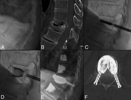 FIG 4.