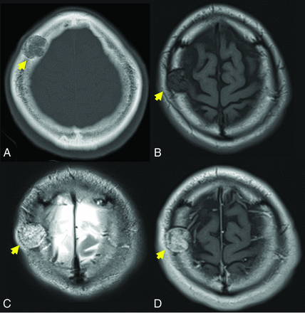 FIG 1.