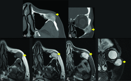 FIG 3.