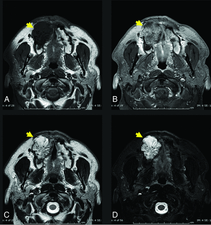 FIG 4.