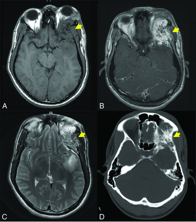 FIG 5.