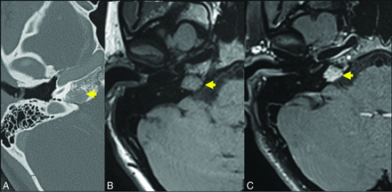 FIG 6.