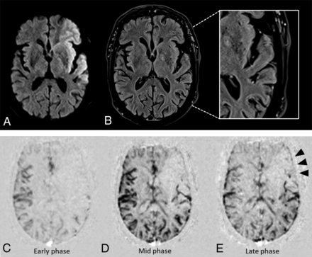 FIG 2.