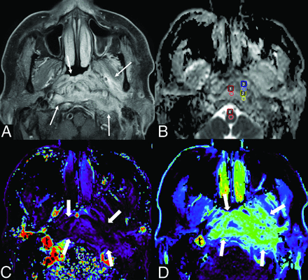 FIG 1.