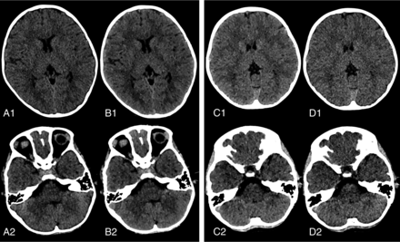 FIG 2.