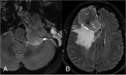 FIG 2.