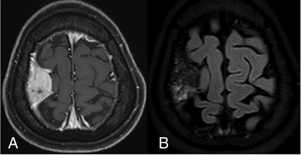 FIG 4.