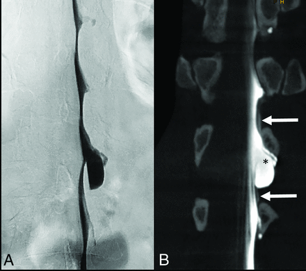 FIG 1.