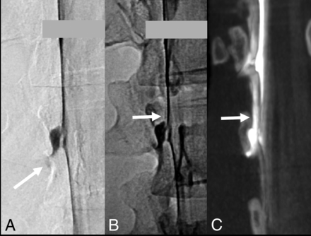 FIG 3.