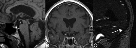 FIG 1.