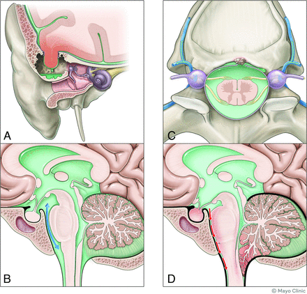 FIG 2.