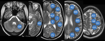 Fig 1.