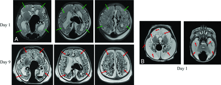 FIG 1.