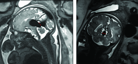 FIG 2.