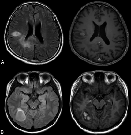FIG 2.