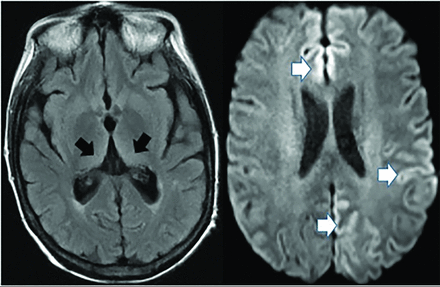 FIG 14.