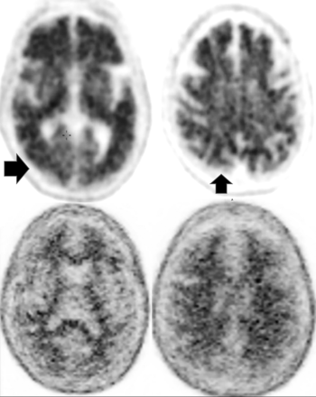 FIG 2.