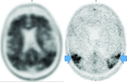 FIG 3.