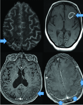 FIG 8.