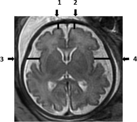 FIG 1.