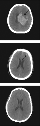 FIG 1.