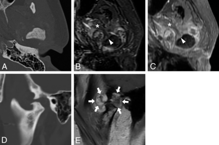FIG 3.