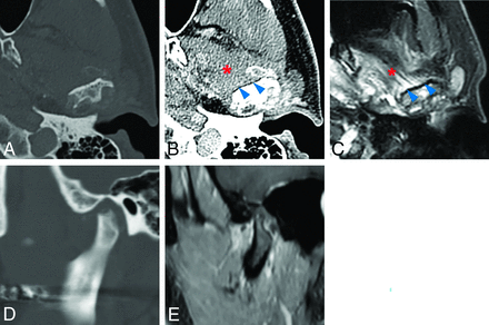 FIG 4.
