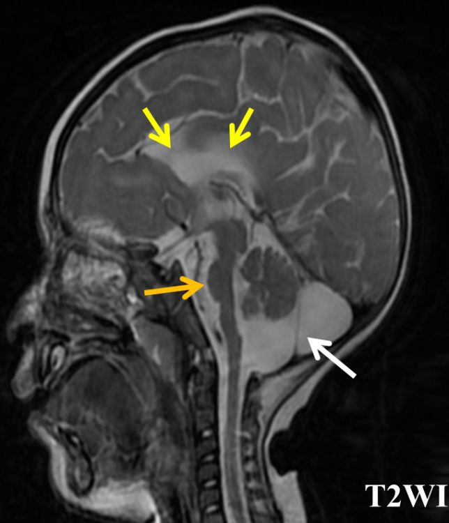 Classic Case American Journal of Neuroradiology