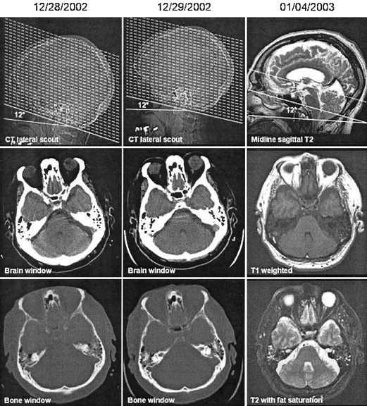 Fig 3. | CT Brain Prescriptions in Talairach Space: A New Clinical