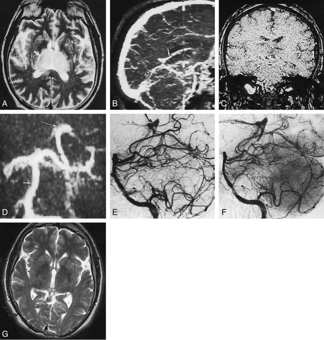 fig 1.