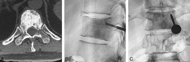 fig 2.