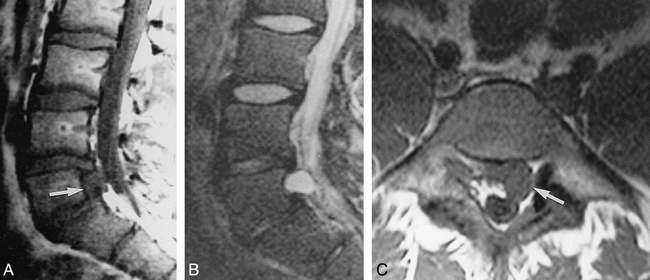 fig 2.