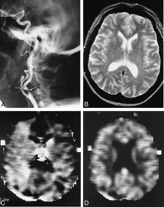 fig 1.