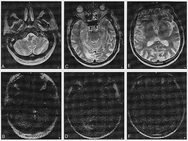 fig 6.