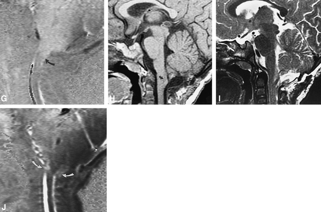 fig 1.