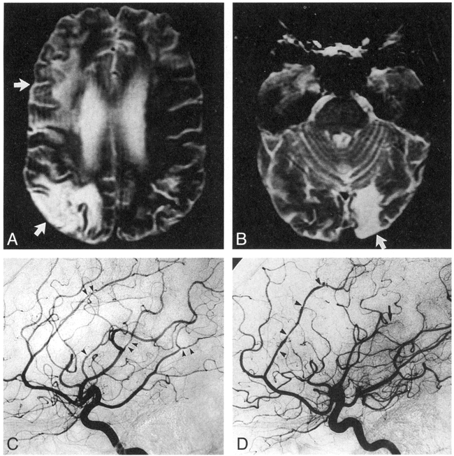 fig 2.