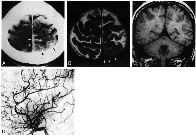 fig 5.