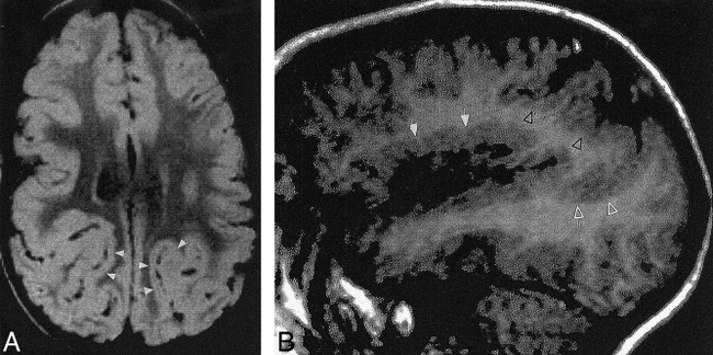 fig 8.