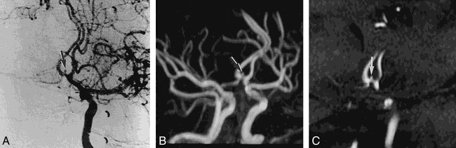 fig 2.