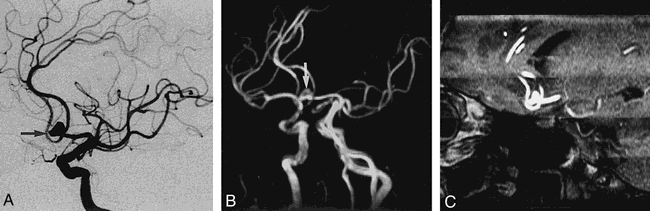 fig 4.