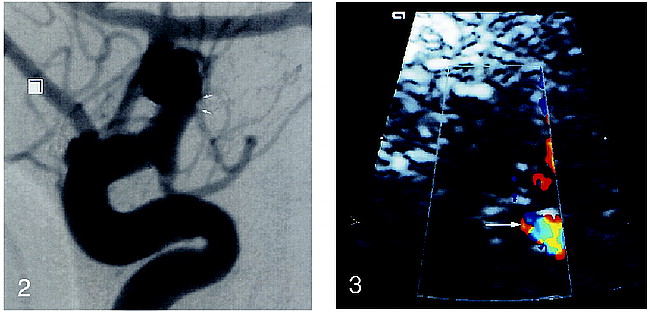 fig 2.