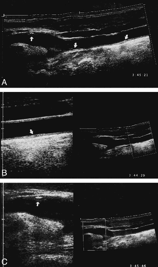 fig 1.