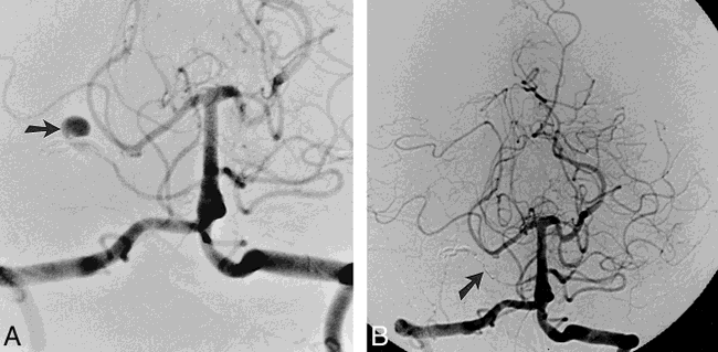 fig 3.