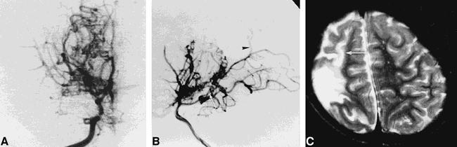 fig 2.