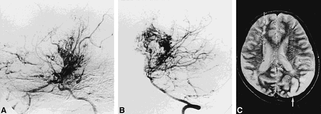 fig 3.