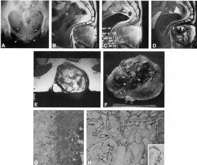 fig 1.