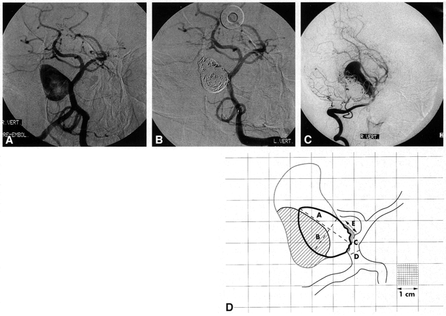 fig 1.