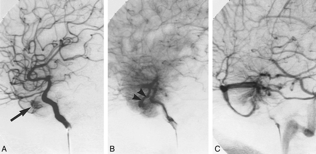 fig 2.