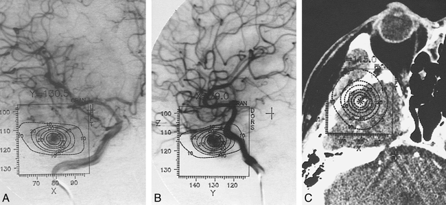 fig 3.