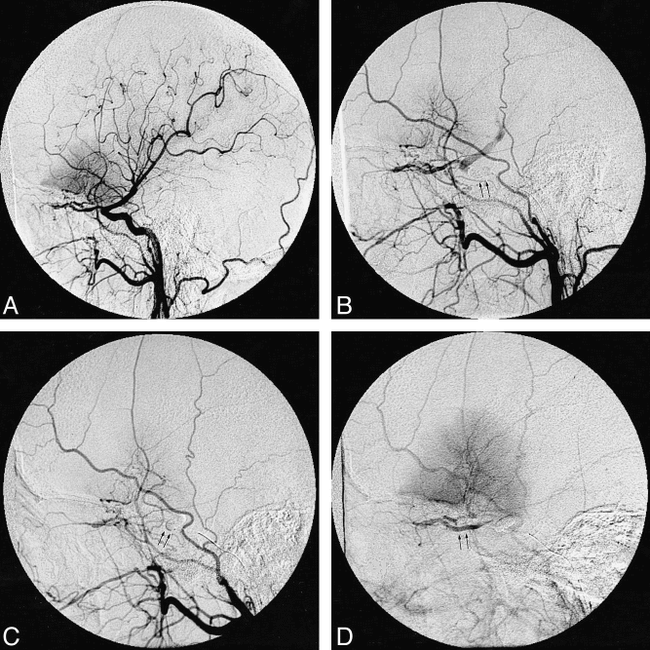 fig 1.